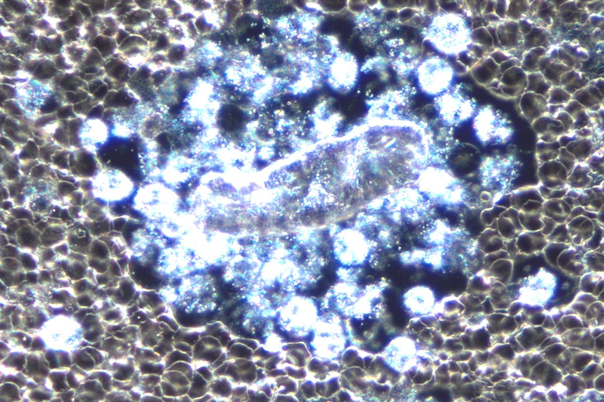 Lc Um Fremdk%C3%B6rper